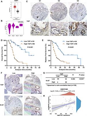 An Integrative Pan-Cancer Analysis Revealing MLN4924 (Pevonedistat) as a Potential Therapeutic Agent Targeting Skp2 in YAP-Driven Cancers